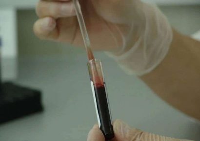 Uno de cada tres muertos por VIH no tenía servicios de salud